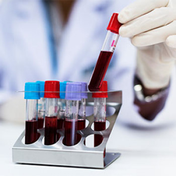 Lab test Image