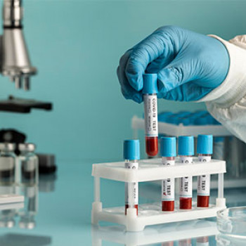 Lab test Image